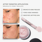 Before-and-after skin comparison showing acne reduction on a person's cheek, alongside a tube of Dr Sebagh Breakout Powder and an open jar of light pink powder on a white background.