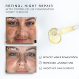 Dr Sebagh Retinol Night Repair before and after, showing visibly reduced pigmentation, a more even tone and smoother skin
